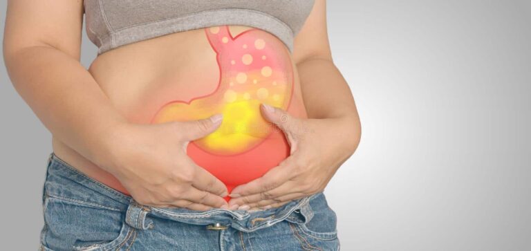 Best Gastric Sleeve Surgery in Tampa